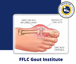 gout institute fflc