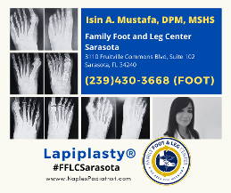 LAPIPLASTY florida