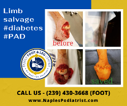 PAD peripheral artery disease 