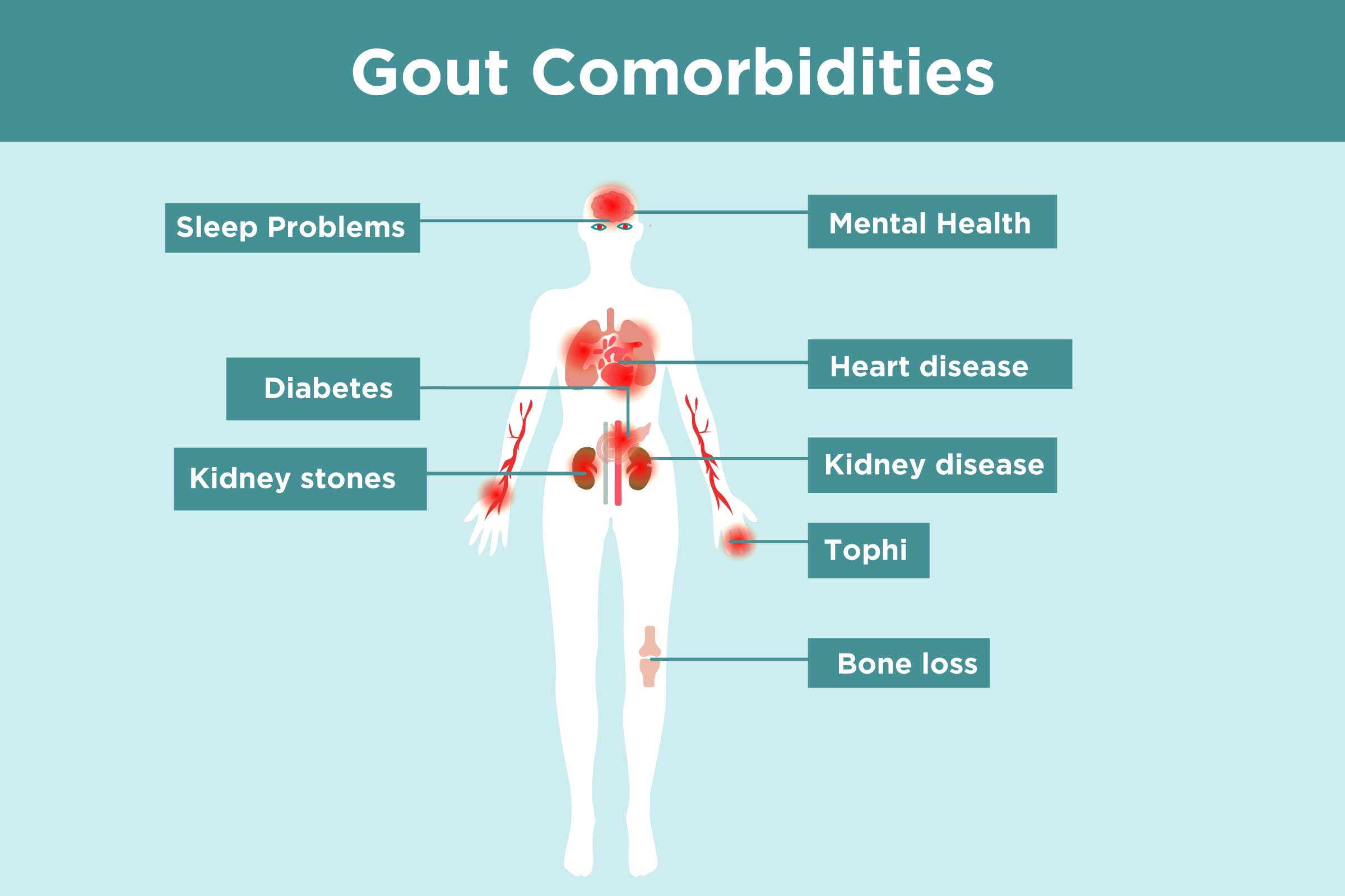 Gout comorbidities