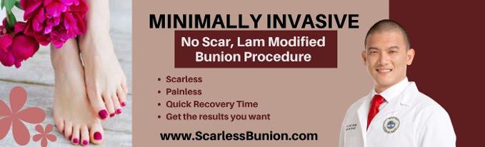 scarless bunion surgery