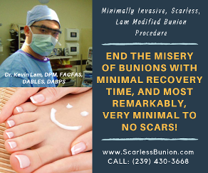 no scar bunion surgery 